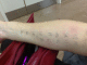 090108.Allery_arm_t.gif